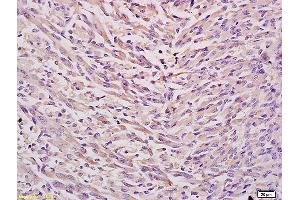 Formalin-fixed and paraffin embedded mouse embryo tissue labeled with Anti EPHX2 Polyclonal Antibody,Unconjugated (ABIN750553) at 1:200 followed by conjugation to the secondary antibody and DAB staining. (EPHX2 Antikörper  (AA 351-450))