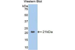 Western blot analysis of the recombinant protein. (GAA Antikörper  (AA 761-919))