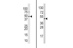Western Blotting (WB) image for anti-Suppressor of Variegation 3-9 Homolog 2 (Drosophila) (SUV39H2) (AA 360-390), (C-Term) antibody (ABIN388082)