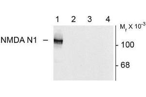 Image no. 1 for anti-NMDA Receptor 1 (NMDA R1) (Splice Variant N1) antibody (ABIN372678) (NMDA 1 Receptor Antikörper  (Splice Variant N1))