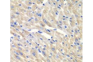 Immunohistochemistry of paraffin-embedded Mouse heart using CARS Polyclonal Antibody at dilution of 1:100 (40x lens). (CARS Antikörper)