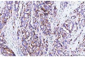 IHC analysis of Poliovirus Receptor/PVR using anti-Poliovirus Receptor/PVR antibody (ABIN7601072). (Poliovirus Receptor Antikörper  (AA 28-331))