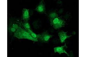 Anti-CDK2 mouse monoclonal antibody (ABIN2454507) immunofluorescent staining of COS7 cells transiently transfected by pCMV6-ENTRY CDK2 (RC200494). (CDK2 Antikörper)