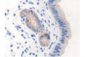 IHC-P analysis of Mouse Uterus Tissue, with DAB staining. (NOS1 Antikörper  (AA 53-247))