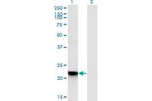 Western Blot analysis of RGS5 expression in transfected 293T cell line by RGS5 monoclonal antibody (M01), clone 4E12.