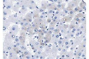 ABIN6268710 at 1/100 staining human liver tissue sections by IHC-P. (BMP5 Antikörper  (Internal Region))