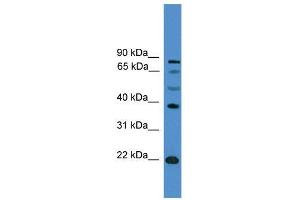 WB Suggested Anti-ASCL2  Antibody Titration: 0. (ASCL2 Antikörper  (C-Term))
