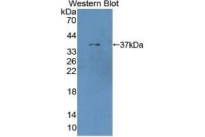 XRN1 Antikörper  (AA 1394-1706)