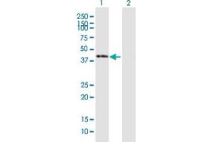 Western Blotting (WB) image for anti-serpin Peptidase Inhibitor, Clade B (Ovalbumin), Member 1 (SERPINB1) (AA 1-379) antibody (ABIN515231)