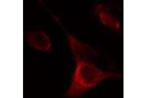 ABIN6275285 staining Hela cells by IF/ICC. (NOX5 Antikörper  (C-Term))