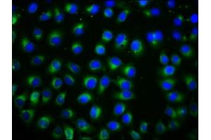 Immunofluorescence staining of A549 cells with ABIN7171846 at 1:133, counter-stained with DAPI. (TSPAN12 Antikörper  (AA 111-224))