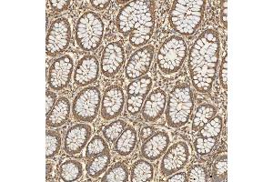 anti-Sorting Nexin 4 (SNX4) (AA 1-450) antibody