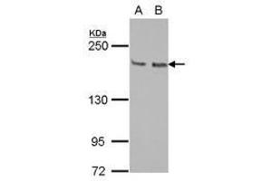 Image no. 1 for anti-Kinesin Family Member 14 (KIF14) (N-Term) antibody (ABIN1494038) (KIF14 Antikörper  (N-Term))