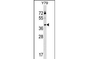 KLHDC8B Antibody (C-term) (ABIN1536933 and ABIN2848637) western blot analysis in Y79 cell line lysates (35 μg/lane). (KLHDC8B Antikörper  (C-Term))