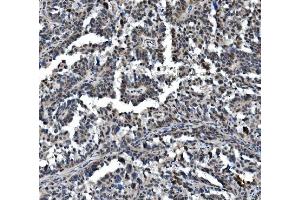 IHC analysis of VPRBP/DCAF1 using anti-VPRBP/DCAF1 antibody (ABIN7599063). (DDB1 and CUL4-Associated Factor 1 (DCAF1) (AA 1-195) Antikörper)