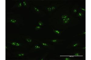 Immunofluorescence of purified MaxPab antibody to PNO1 on HeLa cell. (PNO1 Antikörper  (AA 1-252))