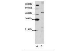 Image no. 1 for anti-Zinc Finger Protein 596 (ZNF596) (AA 424-473) antibody (ABIN203183) (ZNF596 Antikörper  (AA 424-473))