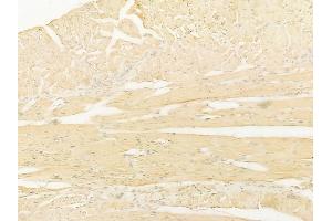 ABIN6266027 and ABIN6267216 at 1/100 staining human tongue carcinoma by IHC-P. (WIPI2 Antikörper  (C-Term))