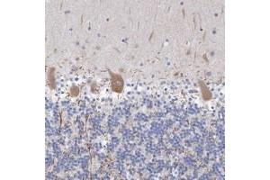 Immunohistochemical staining of human cerebellum with TANC1 polyclonal antibody  shows moderate cytoplasmic positivity in Purkinje cells.