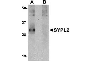 Western Blotting (WB) image for anti-Synaptophysin-Like 2 (SYPL2) (C-Term) antibody (ABIN1030718) (SYPL2 Antikörper  (C-Term))