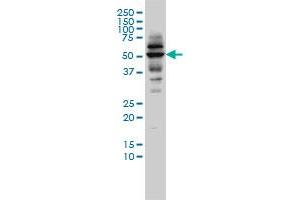CAP2 monoclonal antibody (M01), clone 3G9-1A5 Western Blot analysis of CAP2 expression in C32 . (CAP2 Antikörper  (AA 1-477))