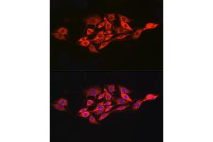 Immunofluorescence analysis of PC-12 cells using IL15RA Rabbit pAb (ABIN3017117, ABIN1680439 and ABIN7101500) at dilution of 1:100 (40x lens). (IL15RA Antikörper  (AA 31-205))