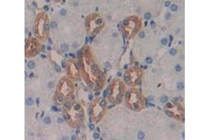 Immunohistochemistry (IHC) image for anti-Renin (REN) (AA 110-221) antibody (ABIN1173893)