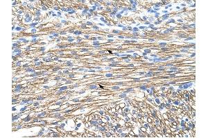 MBNL1 antibody was used for immunohistochemistry at a concentration of 4-8 ug/ml to stain Myocardial cells (arrows) in Human Liver.