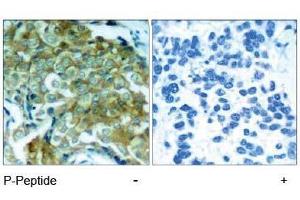 Image no. 1 for anti-Epidermal Growth Factor Receptor (EGFR) (pTyr1172) antibody (ABIN196960) (EGFR Antikörper  (pTyr1172))
