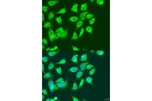 Immunofluorescence analysis of U2OS cells using MCCC2 antibody  at dilution of 1:100. (MCCC2 Antikörper  (AA 284-563))
