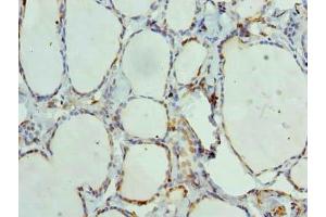 Immunohistochemistry of paraffin-embedded human thyroid tissue using ABIN7144163 at dilution of 1:100 (ANKMY1 Antikörper  (AA 1-220))