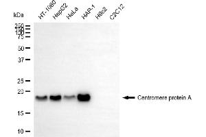Western blotting analysis using centromere protein A antibody (ABIN7798023). (Rekombinanter CENPA Antikörper)