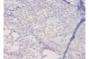 Immunohistochemistry of paraffin-embedded human prostate tissue using ABIN7155589 at dilution of 1:50 (HLA-DQA1 Antikörper  (AA 24-213))