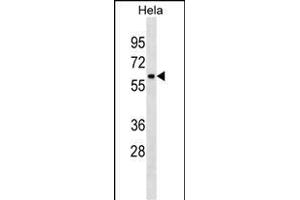 ZN Antibody (C-term) (ABIN1882025 and ABIN2838410) western blot analysis in Hela cell line lysates (35 μg/lane). (ZNF410 Antikörper  (C-Term))
