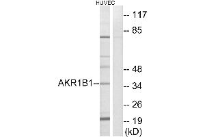 Western blot analysis of extracts from HUVEC cells, using AKR1B1 antibody. (AKR1B1 Antikörper)