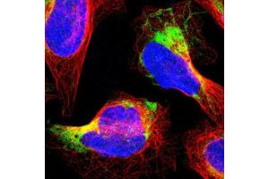 Immunofluorescent staining of human cell line U-2 OS with PTRH2 polyclonal antibody  shows positivity in mitochondria. (PTRH2 Antikörper  (AA 42-178))