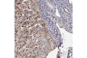 Immunohistochemical staining of human liver with TRAF1 polyclonal antibody  shows strong granular cytoplasmic positivity in hepatocytes. (TRAF1 Antikörper)