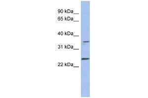 NDN antibody used at 1 ug/ml to detect target protein. (NDN Antikörper)