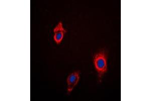 Immunofluorescent analysis of Cytochrome P450 3A4/5 staining in HepG2 cells. (Cytochrome P450 3A4, 3A5 (Center) Antikörper)