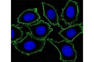 Immunofluorescent analysis of U251 cells using KIT antibody. (KIT Antikörper)
