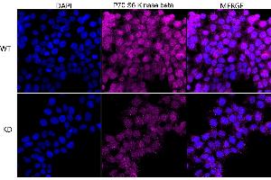 Immunocytochemical staining of HeLa cells using P70 S6 Kinase beta antibody (ABIN7800226), 1:1,000), Top panel: wild-type (WT), Bottom panal: P70 S6 Kinase beta shRNA knockdown (KD). (Rekombinanter RPS6KB2 Antikörper)