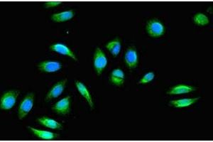Immunofluorescent analysis of Hela cells using ABIN7153133 at dilution of 1:100 and Alexa Fluor 488-congugated AffiniPure Goat Anti-Rabbit IgG(H+L) (FHL2 Antikörper  (AA 112-233))