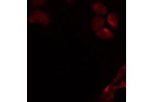 ABIN6274905 staining Hela by IF/ICC. (B3GALT4 Antikörper  (Internal Region))