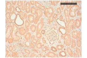 Image no. 1 for anti-Keratin Basic antibody (ABIN341107) (Keratin Basic Antikörper)