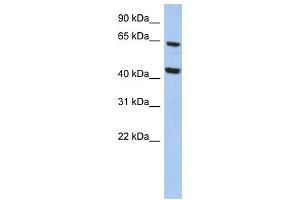 EFHA2 antibody used at 1 ug/ml to detect target protein. (EFHA2 Antikörper  (N-Term))