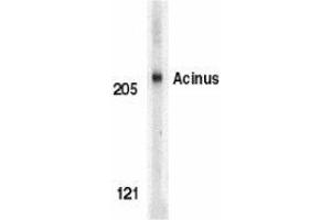 Western blot analysis of Acinus in K562 whole cell lysate with AP30012PU-N Acinus antibody (IN) at 1 μg/ml. (ACIN1 Antikörper  (Intermediate Domain))
