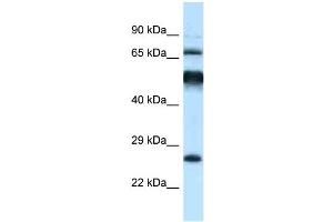 WB Suggested Anti-Klhl1 Antibody Titration: 1. (KLHL1 Antikörper  (C-Term))