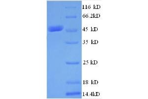SDS-PAGE (SDS) image for MYST Histone Acetyltransferase 2 (MYST2) (AA 1-214), (partial) protein (GST tag) (ABIN4976379) (MYST2 Protein (AA 1-214, partial) (GST tag))