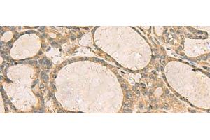 Immunohistochemistry (Paraffin-embedded Sections) (IHC (p)) image for anti-Chemokine (C-X-C Motif) Ligand 1 (Melanoma Growth Stimulating Activity, Alpha) (CXCL1) antibody (ABIN7248116)