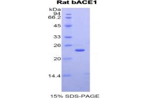 SDS-PAGE analysis of Rat bACE1 Protein.